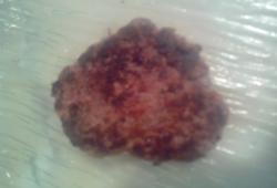 Recette Dukan : Steack hach� au carr� frais